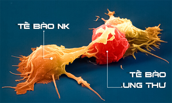 Tế bào miễn dịch NK tự tìm và tiêu diệt tế bào ung thư