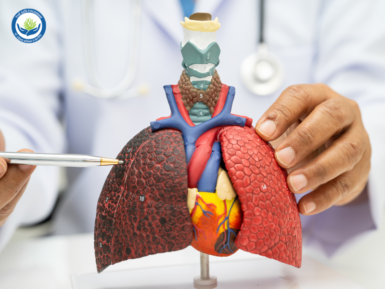 Ung thư phổi là bệnh lý ác tính bắt nguồn từ sự phát triển mất kiểm soát của các tế bào trong mô phổi