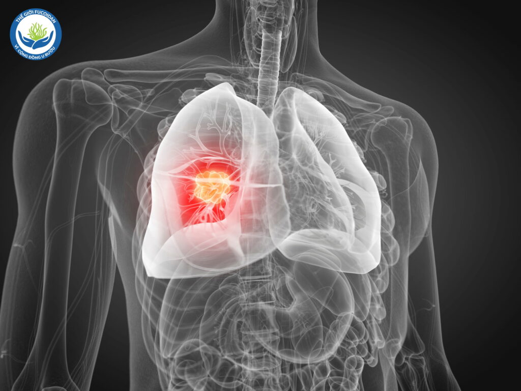 Chủ động tầm soát sớm giúp phát hiện và điều trị kịp thời